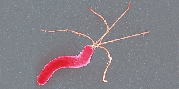 Nueva vía de desarrollo contra la bacteria Helicobacter pylori.