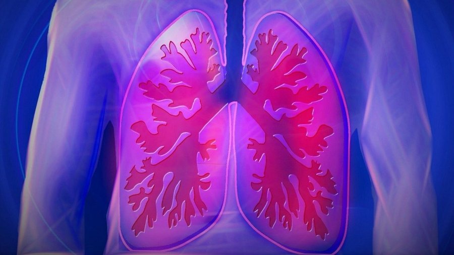 pulmon