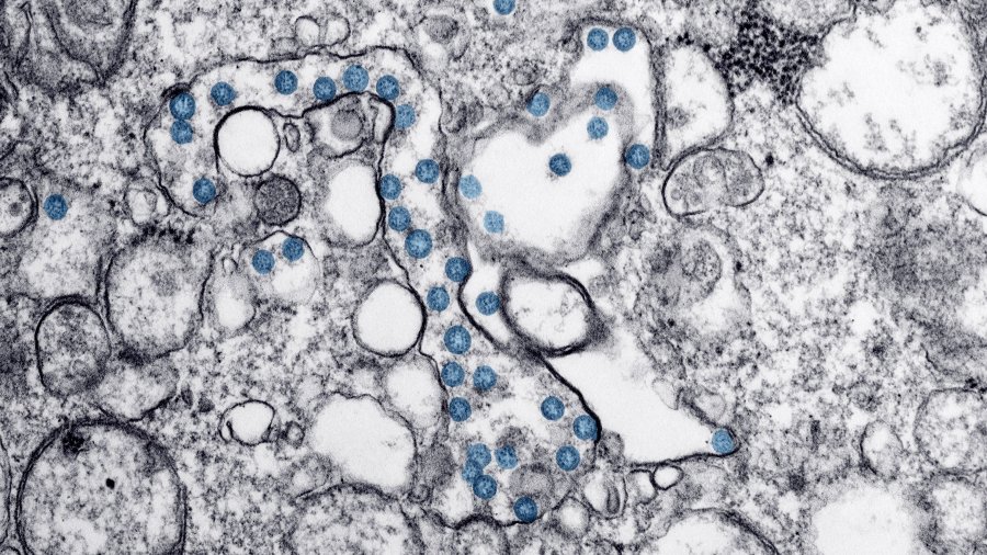 coronavirus-csic