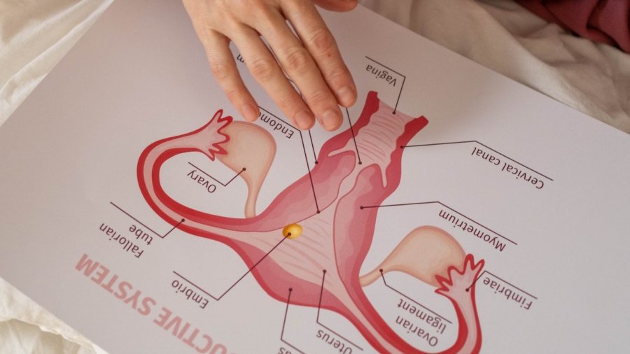 Día Internacional de Concienciación sobre el VPH.