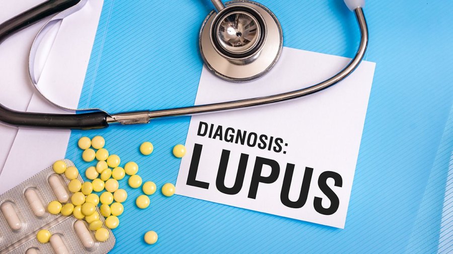 lupus conocimiento