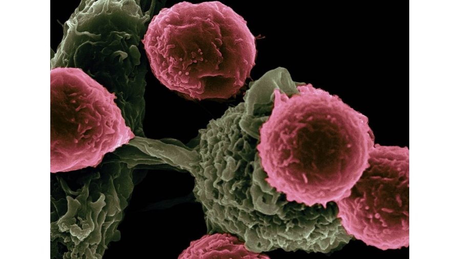 desarrollo de moléculas sintéticas para mejorar el tratamiento del cáncer.
