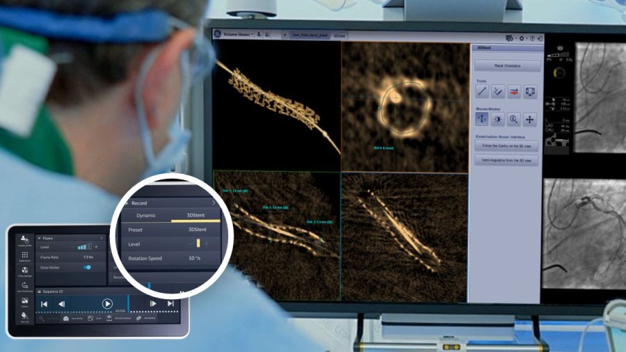 3DStent de GE HealthCare es una innovadora reconstrucción intraprocedimental de endoprótesis en 3D diseñada para eliminar las principales barreras de imagen de endoprótesis y proporcionar imágenes fáciles de interpretar.