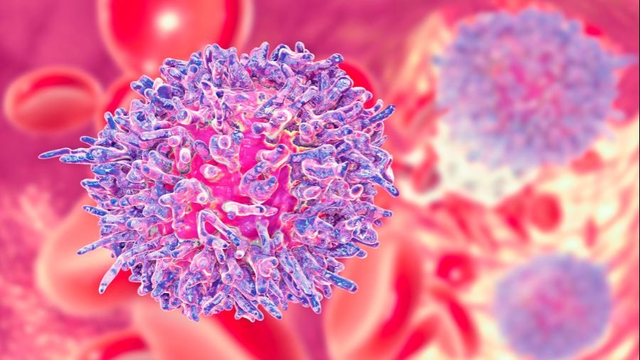CAR-T neoplasias hematologicas