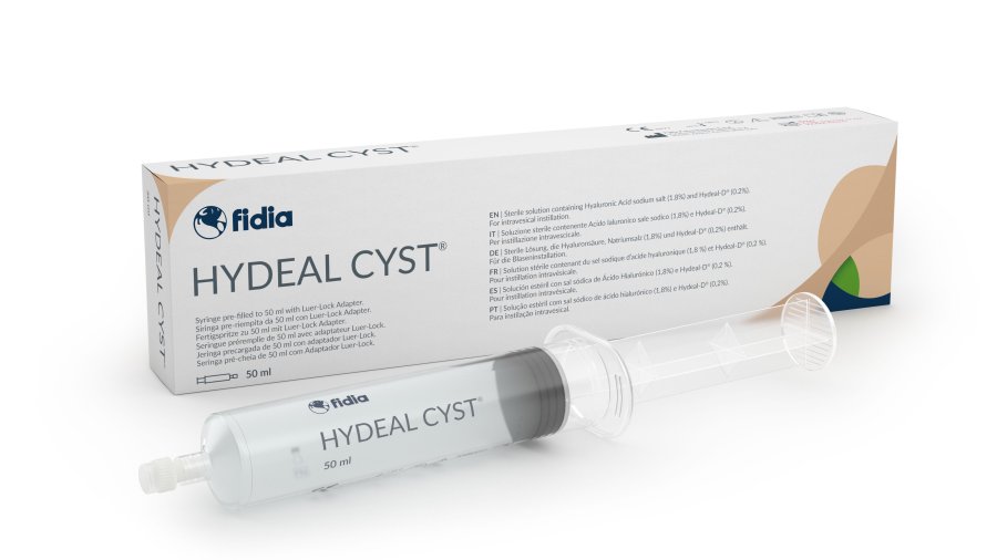 Hydeal Cyst