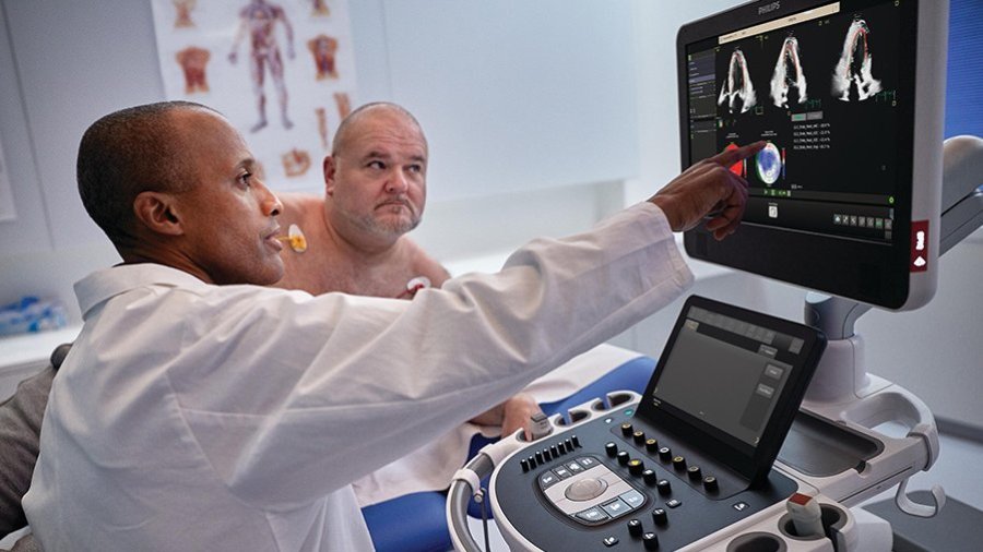 Sistema de ultrasonidos Trascend Plus Sistema de ultrasonidos Trascend Plus