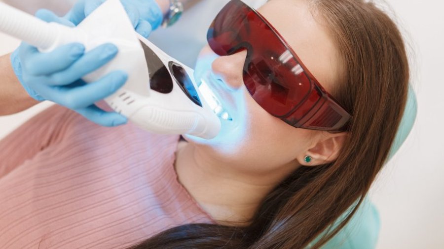 Blanqueamiento dental. Foto: Juan Floriano Reviriego