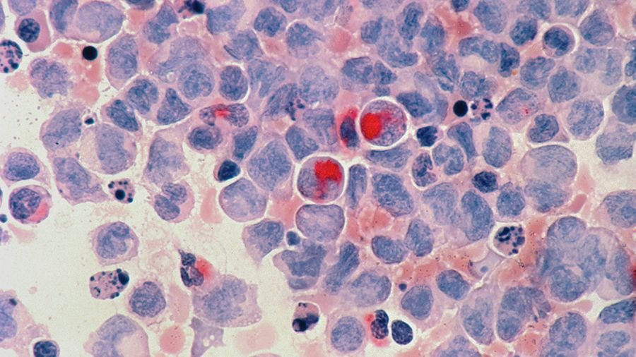 Foto: National-cancer-institute-mbL91Lg56zc-unsplash