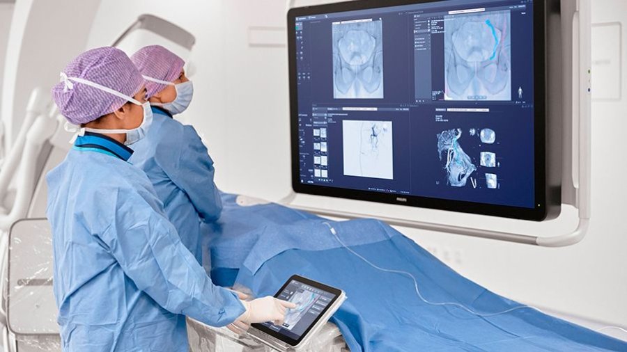 philips-azurion-interventional-oncology