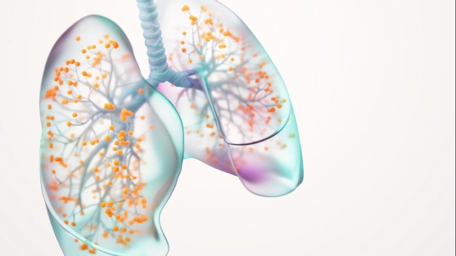 Enfermedades respiratoria. Foto: GSK