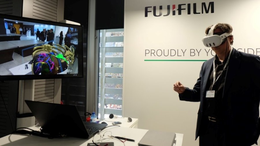 Foto: Tecnología SYNAPSE 3D de Fujifilm Healthcare