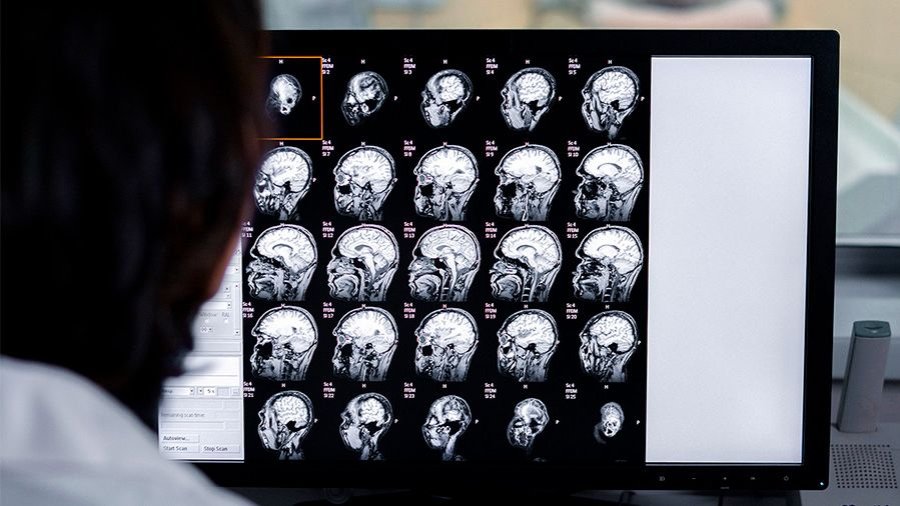 Resonancia magnética CEREBRO