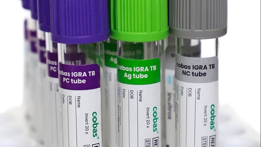 IGRA TB tubes key visual